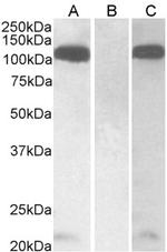 Furin Antibody in Western Blot (WB)