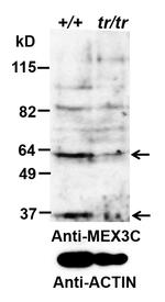 RKHD2 Antibody in Western Blot (WB)