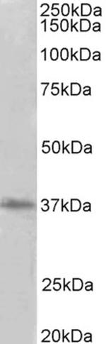 PRMT2 Antibody in Western Blot (WB)