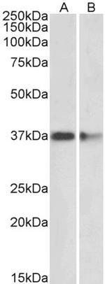 PRMT2 Antibody in Western Blot (WB)