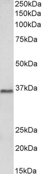 PRMT2 Antibody in Western Blot (WB)