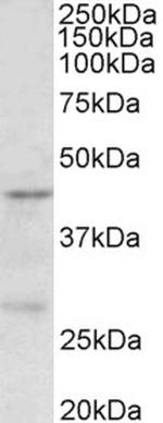 PRMT6 Antibody in Western Blot (WB)