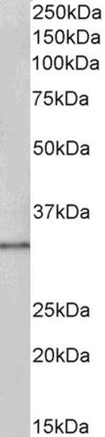 PCNA Antibody in Western Blot (WB)