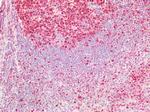 PCNA Antibody in Immunohistochemistry (Paraffin) (IHC (P))