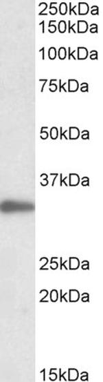 PCNA Antibody in Western Blot (WB)