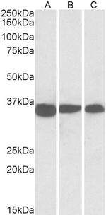 PCNA Antibody in Western Blot (WB)