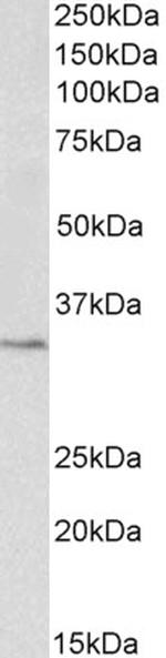 PCNA Antibody in Western Blot (WB)