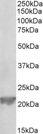 GPX1 Antibody in Western Blot (WB)