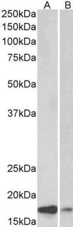 alpha Synuclein Antibody in Western Blot (WB)