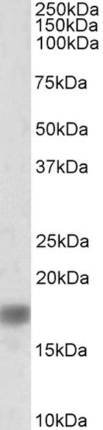 alpha Synuclein Antibody in Western Blot (WB)