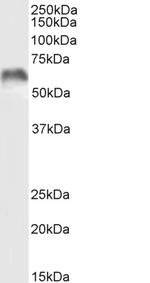 MMP3 Antibody in Western Blot (WB)