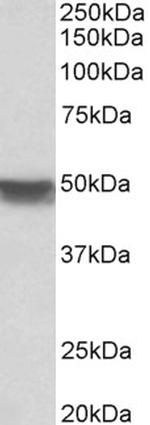 Cytokeratin 20 Antibody in Western Blot (WB)