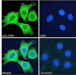 CTGF Antibody in Immunocytochemistry (ICC/IF)