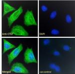 CTGF Antibody in Immunocytochemistry (ICC/IF)