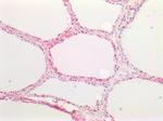 CTGF Antibody in Immunohistochemistry (Paraffin) (IHC (P))