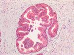 VCP Antibody in Immunohistochemistry (Paraffin) (IHC (P))