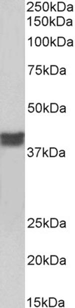 Cardiac Troponin T Antibody in Western Blot (WB)