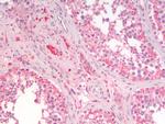 SGTA Antibody in Immunohistochemistry (Paraffin) (IHC (P))