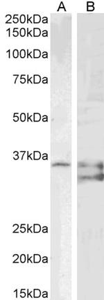 SGTA Antibody in Western Blot (WB)