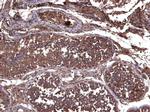 LIF Antibody in Immunohistochemistry (Paraffin) (IHC (P))