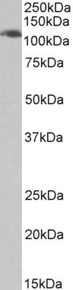 AP2A1 Antibody in Western Blot (WB)