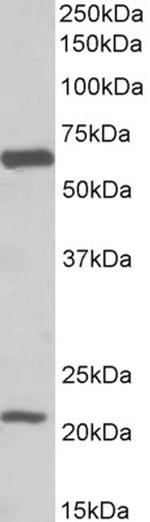 GLAST Antibody in Western Blot (WB)