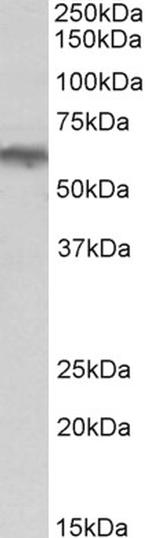 alpha-1b Adrenergic Receptor Antibody in Western Blot (WB)