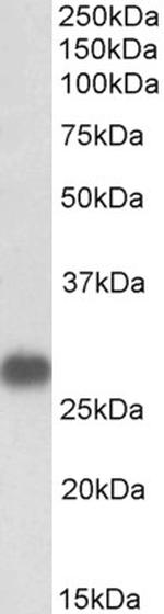 Cardiac Troponin I Antibody in Western Blot (WB)