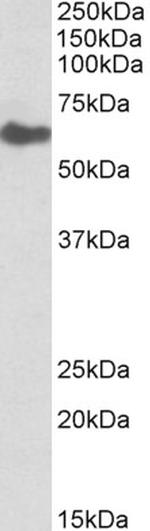 GGT1 Antibody in Western Blot (WB)