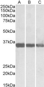 MDH1 Antibody in Western Blot (WB)