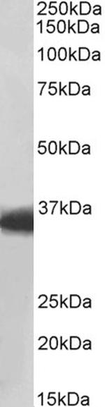 MDH1 Antibody in Western Blot (WB)