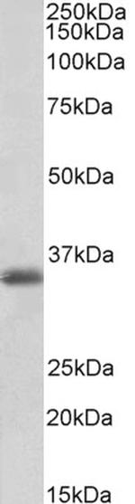 MDH1 Antibody in Western Blot (WB)