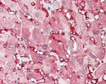 Creatine Kinase MM Antibody in Immunohistochemistry (Paraffin) (IHC (P))