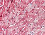 FABP3 Antibody in Immunohistochemistry (Paraffin) (IHC (P))