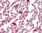 PLK3 Antibody in Immunohistochemistry (Paraffin) (IHC (P))