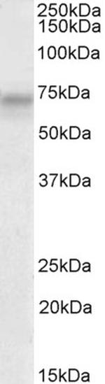 PLK3 Antibody in Western Blot (WB)