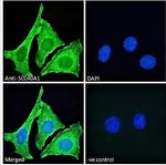 Ferroportin Antibody in Immunocytochemistry (ICC/IF)