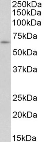 IFNAR1 Antibody in Western Blot (WB)