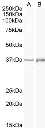 DLX2 Antibody in Western Blot (WB)