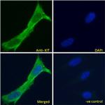 c-Kit Antibody in Immunocytochemistry (ICC/IF)