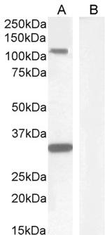 c-Kit Antibody in Western Blot (WB)