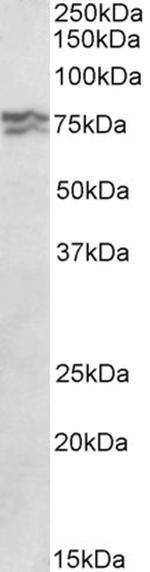 RPA70 Antibody in Western Blot (WB)