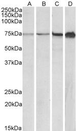 RPA70 Antibody in Western Blot (WB)