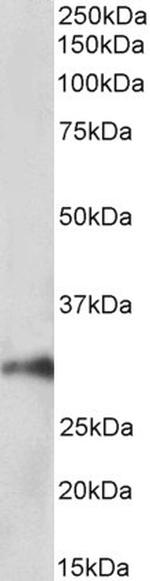 HOXA5 Antibody in Western Blot (WB)