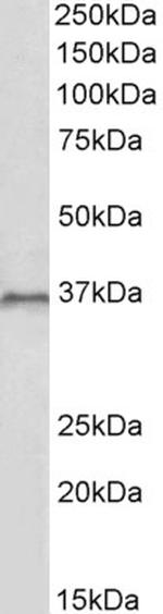 HOXC10 Antibody in Western Blot (WB)