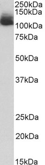 NALP12 Antibody in Western Blot (WB)