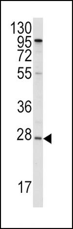 ApoA1 Antibody in Western Blot (WB)