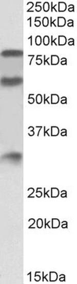 Kininogen 1 Antibody in Western Blot (WB)