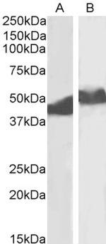 alpha-1 Antitrypsin Antibody in Western Blot (WB)