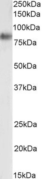 SR-BI Antibody in Western Blot (WB)